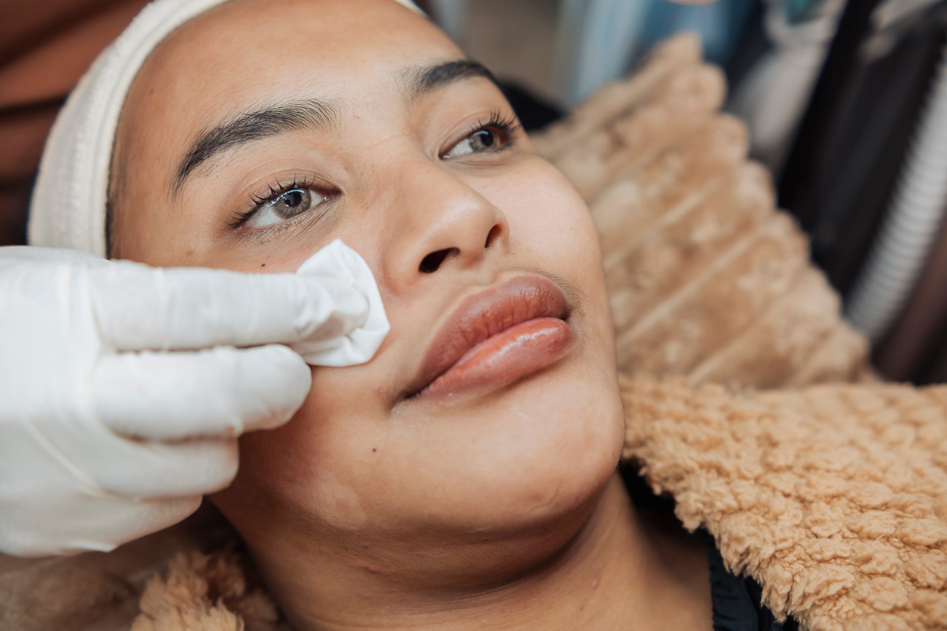 Skin resurfacing and clarifying treatment in progress