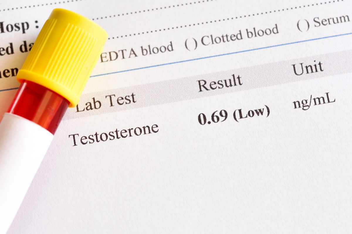 Blood sample tube beside a lab report showing a low testosterone result